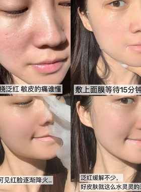 贴片面膜双亲急救修护舒缓镇静