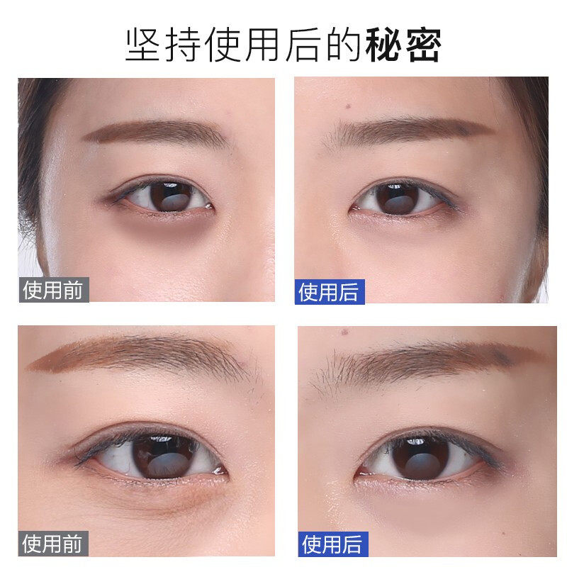 ahc /爱和纯第7代保湿滋润眼霜 台北浅草风海外眼霜