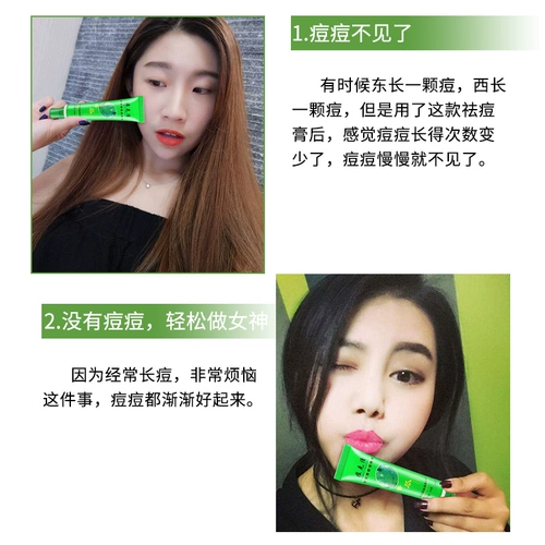 Подлинные прыщи Lu Lanjina, горькая тыква, крем с прыщами, прыщи, продукты прыщей, прыщи, флагманский магазин с прыщами, гель.