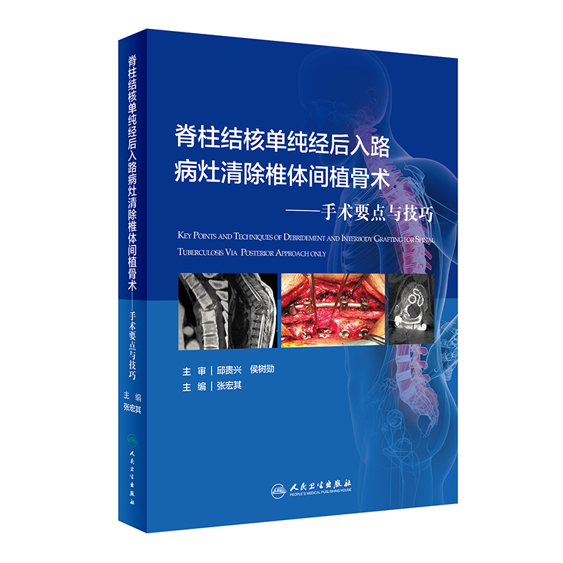 脊柱结核单纯经后入路病灶清除与椎体间植骨术——手术要点与技巧（配增值） - 图0