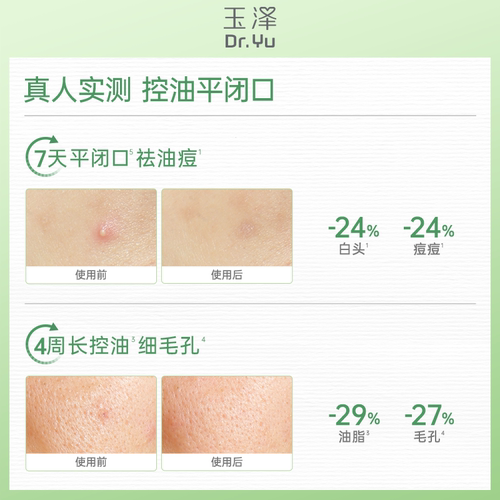 玉泽四酸控油乳祛痘乳液水杨酸油皮痘肌控油保湿青蒿舒缓修护闭口 - 图1