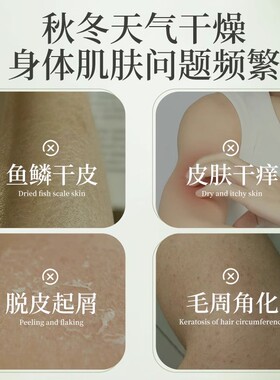 百年扁氏艾草痒止润肤露官方正品去屑保湿用舒缓解干燥乳医舰旗店