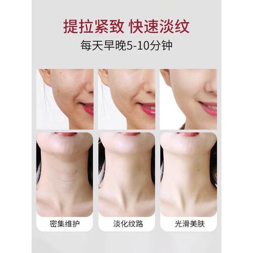 正品莎曼莉提拉紧致按摩导入美容仪器面脸部小海豚家用淡颈纹去 - 图2