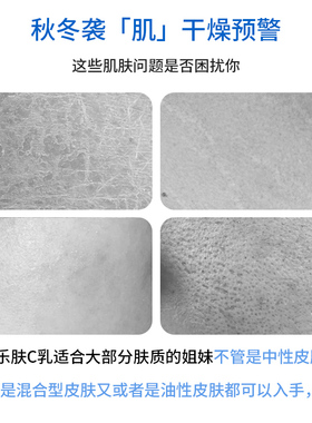 官方正品适乐肤润肤乳保湿