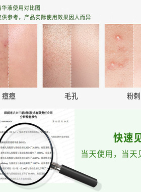 馥珮祛痘舒缓精华液去粉刺青春痘