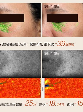 hbn眼部精华2.0优惠三天！
