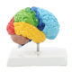Anatomical neurocortical model of the right hemiplegia of the human brain