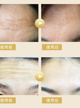 淡化皱纹NATURABLANC紧致额头贴