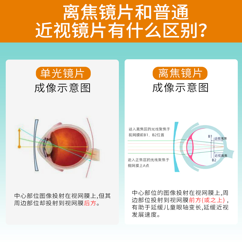 康视控儿童青少年星趣控多点离焦近视防控镜片减缓度数加深眼镜 - 图2