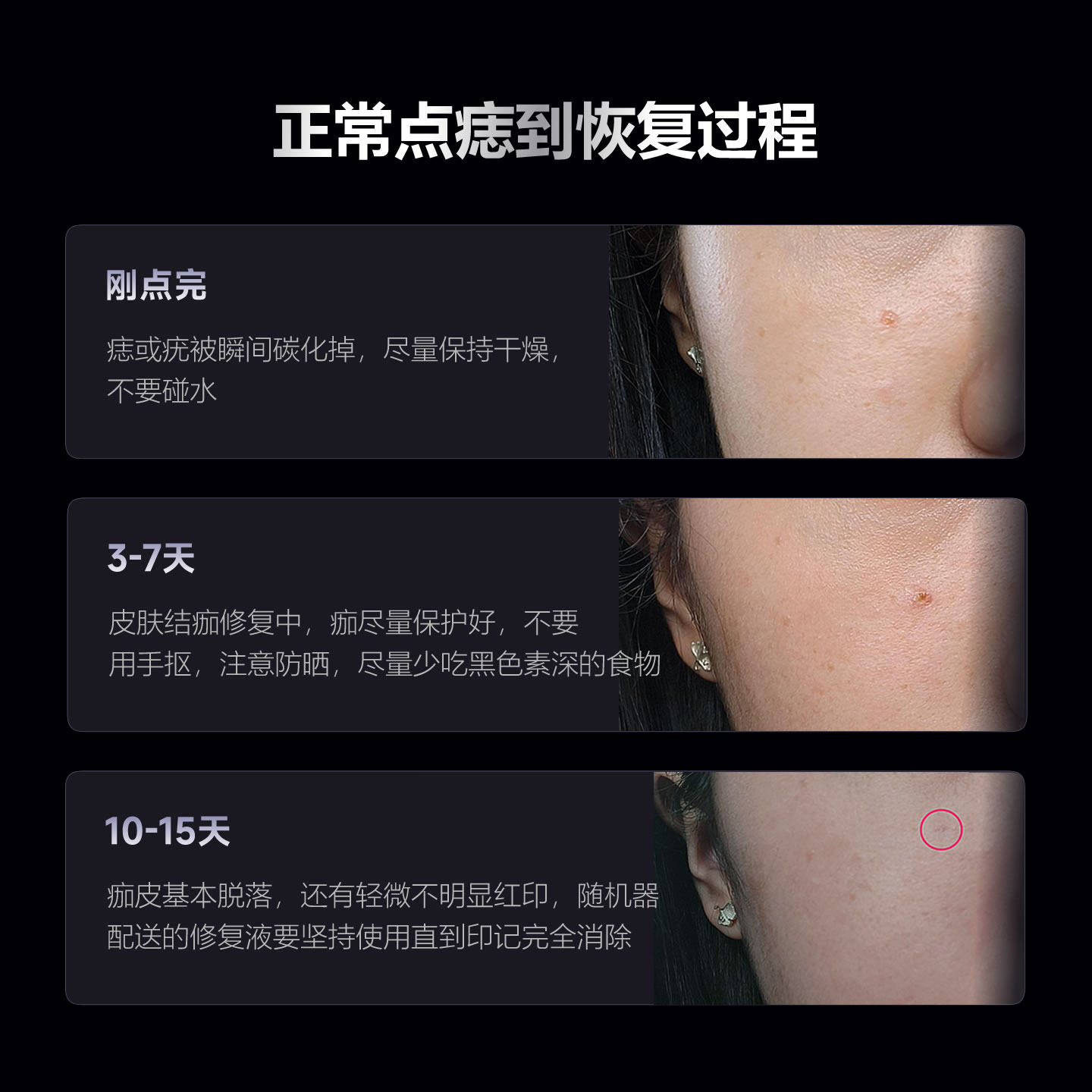 蓝白双光点疣点痣笔美容院专用痦子肉粒疙瘩去除祛扫斑激光美容仪,淘宝优惠券,粉丝福利购,淘宝优惠卷