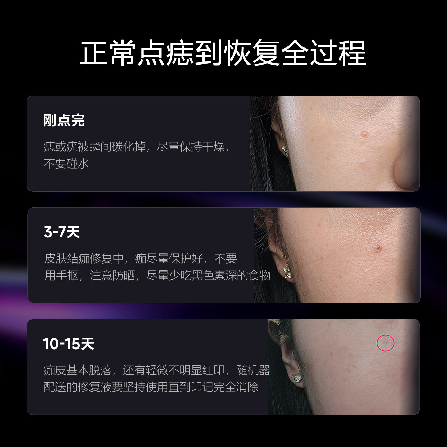 红蓝光点痣点疣笔充插电两用美容院离子祛扫斑激光笔尤猴去除仪器,淘宝优惠券,粉丝福利购,淘宝优惠卷