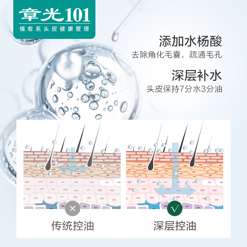 章光101洗发水控油蓬松去屑止痒清爽柔顺洗头膏露官方正品男女-图0