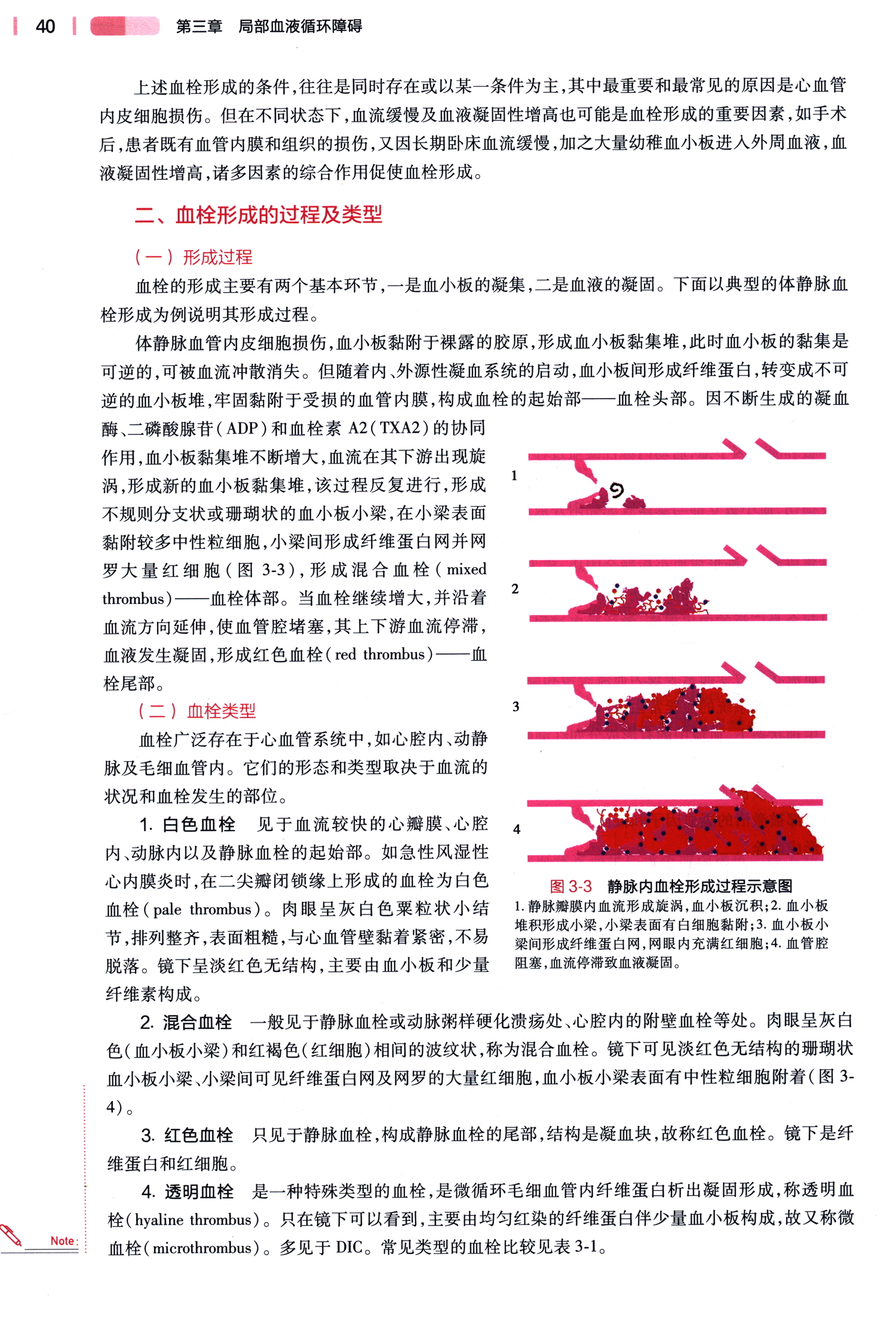 病理学与病理生理学第五5版十四五规划教材全国高等学校教材供本科护理学类专业用步宏王雯人民卫生出版社9787117327404-图0