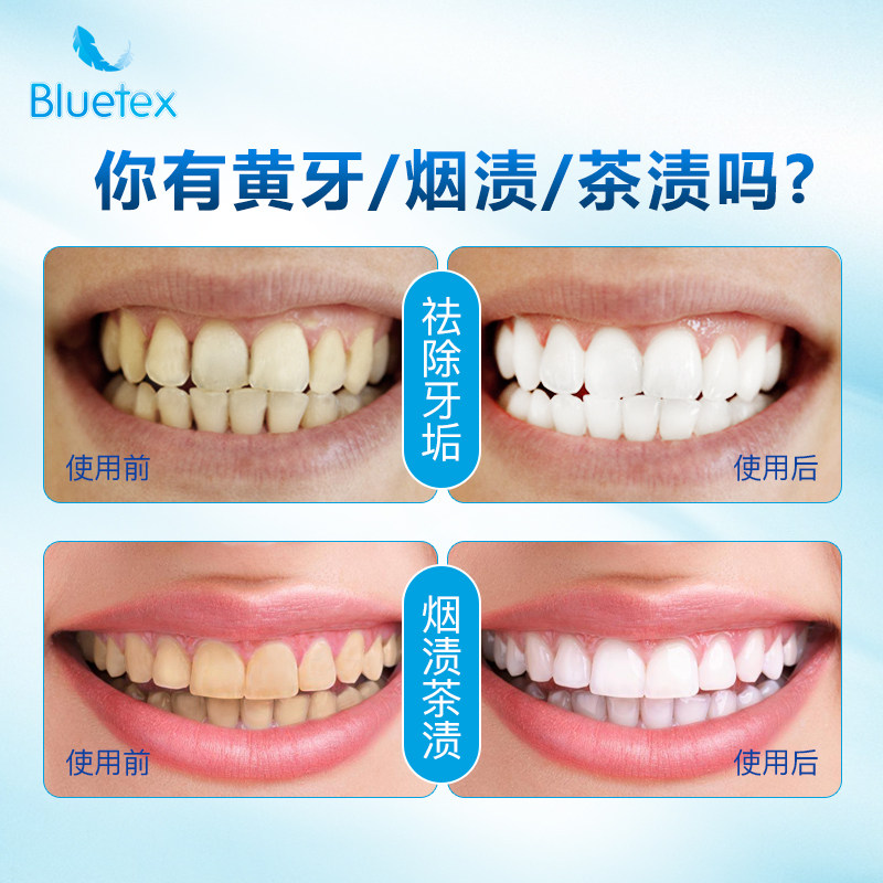 蓝宝丝美白牙齿黄牙去黄白除去牙粉 bluetex牙粉