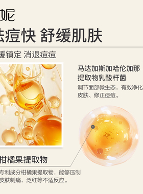芬妮祛痘清肌精粹水180ml