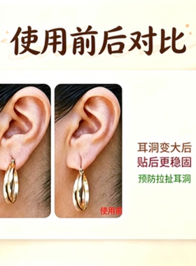 重耳饰减压贴保护耳垂防撕裂