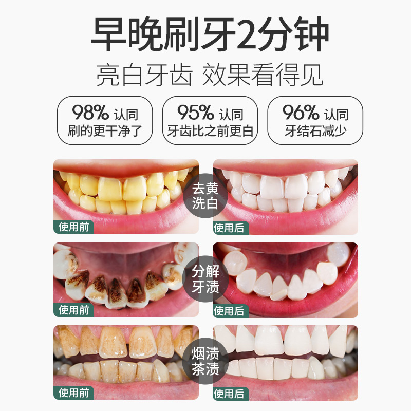 去黄洗白污垢除牙石牙齿洗牙粉 萃肌蓝居家日用牙粉