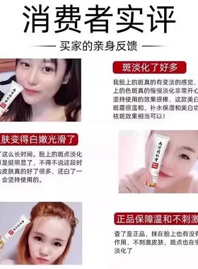 去老人斑专用药膏去斑霜祛老年斑专用脸部去手上手部手背