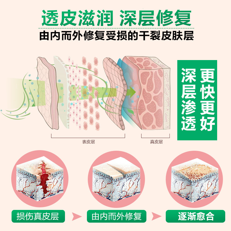 脚后跟干裂手足防裂皲裂手脚跟膏 金泰康铃医护手霜