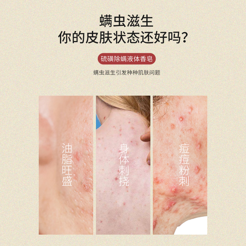 白云山硫磺除螨沐浴露男女留香后背痘红点疙瘩止痒杀菌液体香皂_益福康品牌严选_洗护清洁剂/卫生巾/纸/香薰-第3张图片-提都小院