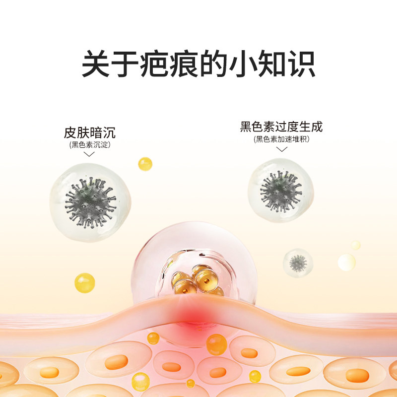 医用疤痕贴硅凝胶疤痕修复贴剖腹产儿童烧烫伤增生去疤祛疤除疤膏