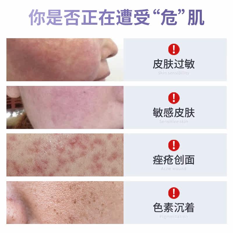 泰恩康皮肤过敏轻中度痤疮女士凝胶 泰恩康伤口敷料