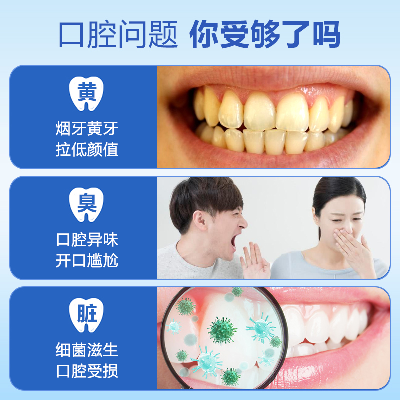 扬美旗舰店扬美洁牙慕斯泡沫牙膏去口臭去黄牙垢亮白清新口气美白去牙渍结石0