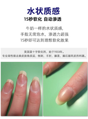 bluecross蓝十字死皮软化剂指缘