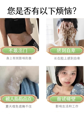 复方补骨脂酊促黑色素生长外用