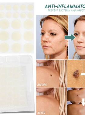 Skin Tag Remover Patch Pimple Wart Treatment Cream Quick Ab