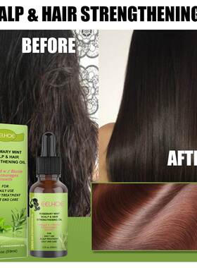 rosemary mint hair strengthening oil hair growth fluid scalp