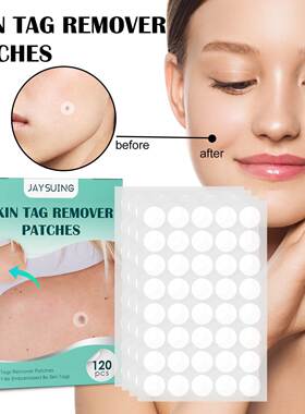 wart patch Dot mole wart wart wart callus meat flat filament