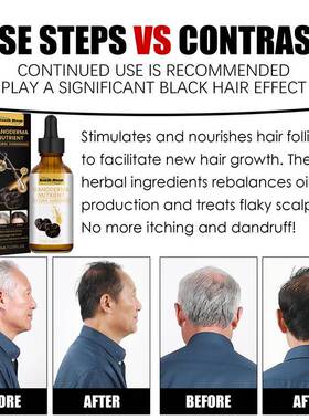 Effective Gray White Hair Treatment Serum Liquid Natural Col