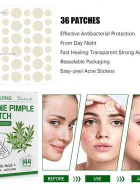 144 Patches Acne Patch Tea Tree Oil Face Invisible Stickers