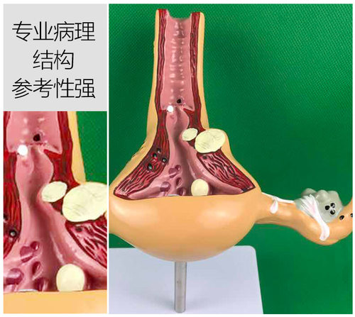 人体子宫模型教具模具阴道卵巢解剖病理医学女性仿真女性生殖模器 - 图1