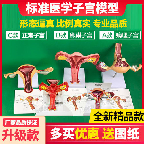 人体子宫模型教具模具阴道卵巢解剖病理医学女性仿真女性生殖模器 - 图2