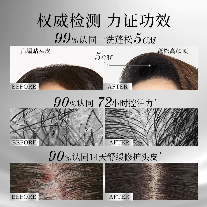 滋源控油绿极光瓶洗发水 控油蓬松平衡洗头水修护旗舰官方正品