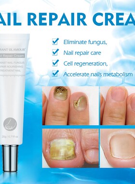 Nail Repair Cream Nail Fungus Treatment Onychomycosi指甲修复