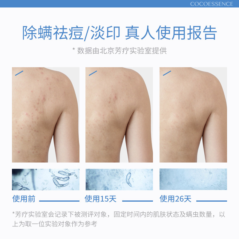 香港后背部除螨虫皂喷雾粉刺沐浴盐 cocoessence华氏佳合专卖浴盐