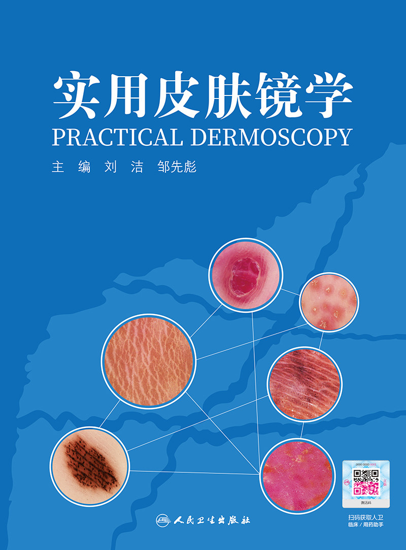 实用皮肤学人卫刘洁邹先彪银屑病镜 博蓝图书皮肤病学/性病学