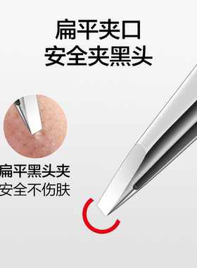 高精密黑头粉刺夹安全