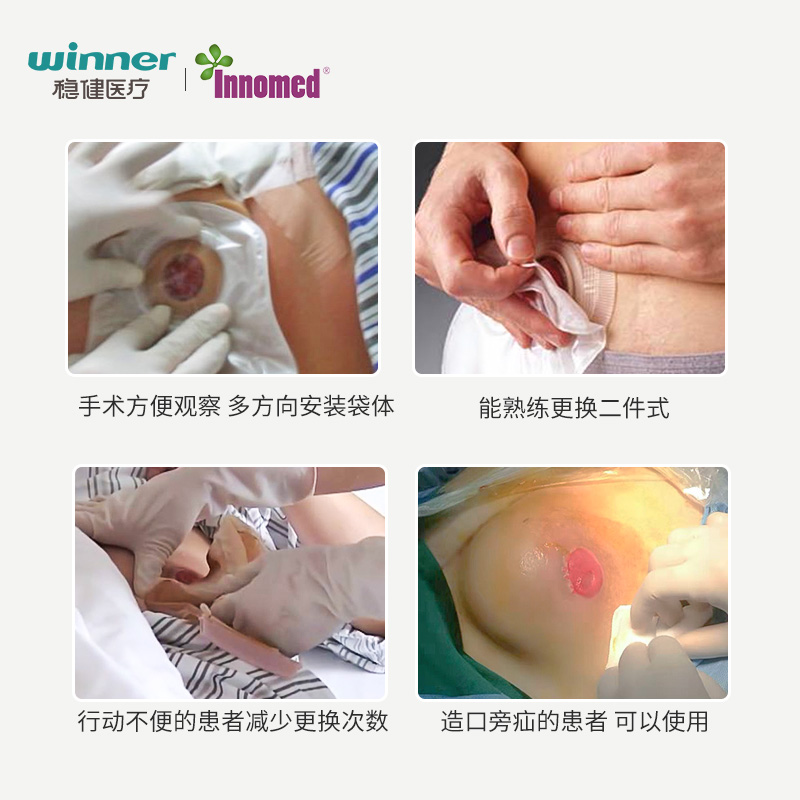 稳健隆泰二件式造口袋腹带底盘大便造瘘袋医用两件式套装innomed