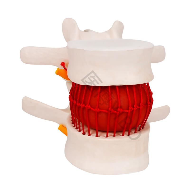 医博BIX-A3561人体腰椎间盘突出病变演示模型人体脊柱腰椎模型人O - 图3