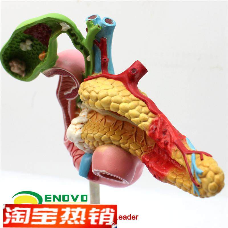 ENOVO颐诺医学胰腺十二指肠胆囊病G理模型外科消化科系统模具肝胆,淘宝优惠券,粉丝福利购,淘宝优惠卷