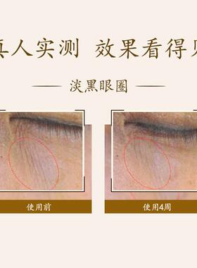 马应龙眼霜淡化皱纹眼圈紧致抗皱补水保湿眼部护理精华缓解眼疲劳