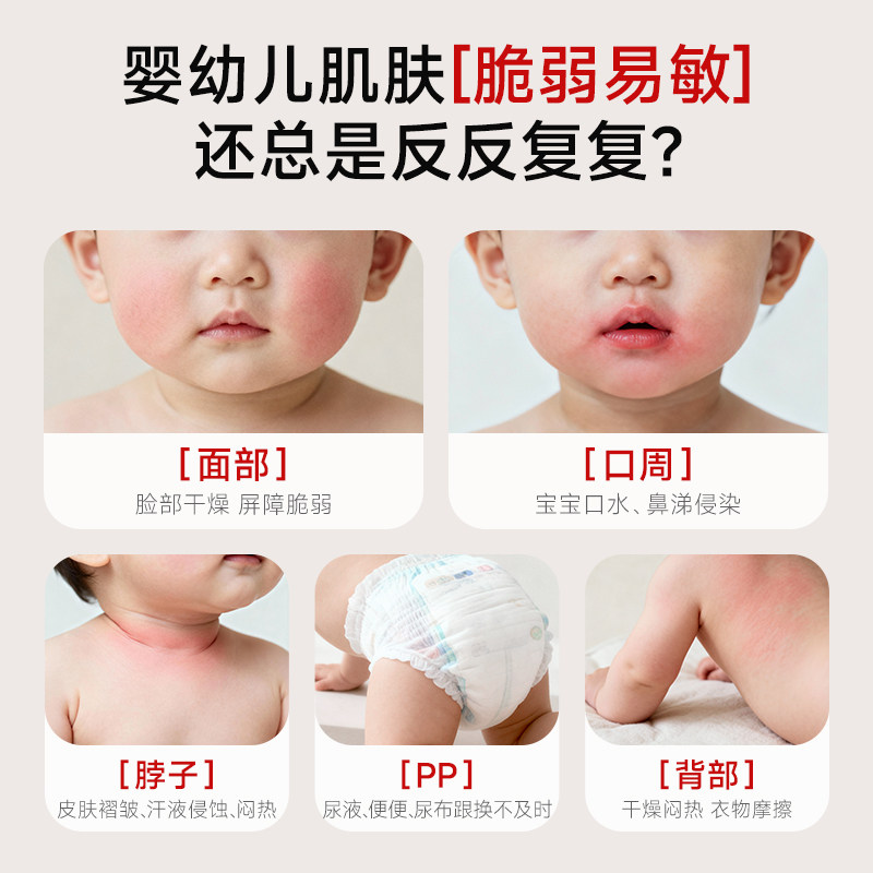 妙抚湿湿乐婴儿唇周膏宝宝口水膏专用唇周护理膏婴幼儿面霜非疹膏
