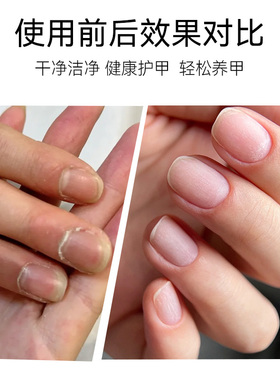 美甲专用去死皮修甲套装死皮剪