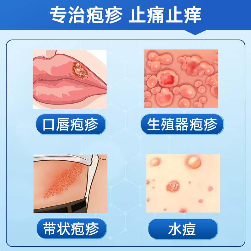 丽芙阿昔洛韦凝胶官方旗舰店阿昔洛韦软膏乳膏正品带状疱疹惜