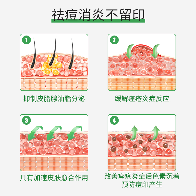 阿达帕林凝胶正品官方旗舰店阿达 帕林凝胶祛去黑头阿达林帕凝胶 - 图0