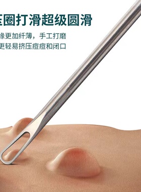闭口暗疮针钛合金一体粉刺针